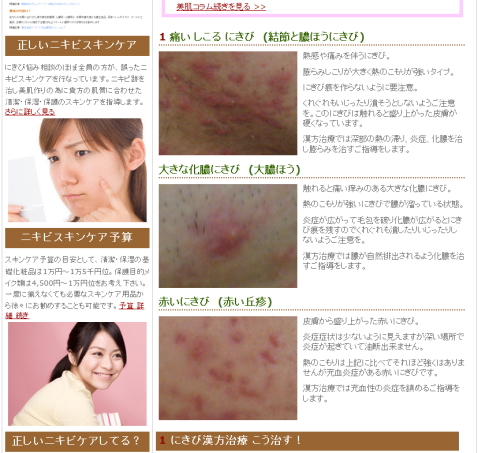 にきび 漢方 治療 治癒写真 口コミ評判 ニキビ予算治療法 東京河合薬局
